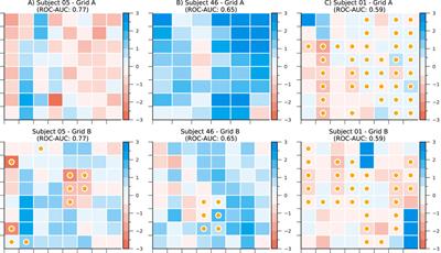 Connectivity of high-frequency bursts as SOZ localization biomarker